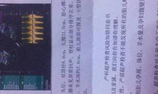 胎儿颈部可见u型切迹 胎儿颈部可见u型切迹