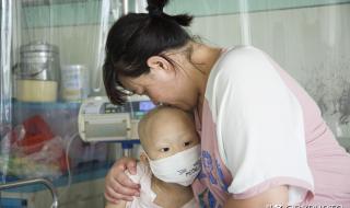 白细胞高会得白血病吗